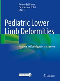 Abbildung von: Pediatric Lower Limb Deformities - Springer