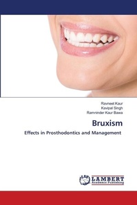 Abbildung von: Bruxism - International Book Market Service Ltd