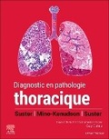 Cover: Diagnostic en pathologie thoracique - Masson