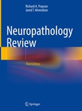 Abbildung von: Neuropathology Review - Springer