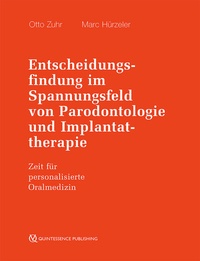 Abbildung von: Entscheidungsfindung im Spannungsfeld von Parodontologie und Implantattherapie - Quintessenz Verlag
