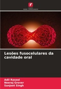 Cover: Lesoes fusocelulares da cavidade oral - Edicoes Nosso Conhecimento