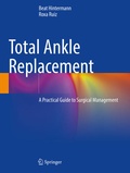 Cover: Total Ankle Replacement - Springer