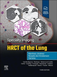 Abbildung von: Specialty Imaging: HRCT of the Lung - Churchill Livingstone