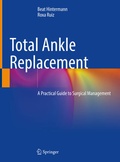 Cover: Total Ankle Replacement - Springer