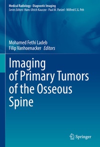 Abbildung von: Imaging of Primary Tumors of the Osseous Spine - Springer