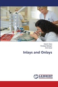 Cover: Inlays and Onlays - LAP Lambert Academic Publishing