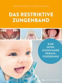 Abbildung von: Das restriktive Zungenband - Quintessenz Verlag