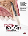 Cover: Tooth or Implant - Edra Publishing US LLC
