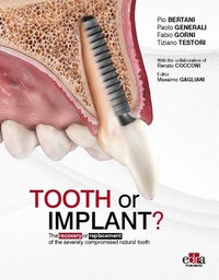 Abbildung von: Tooth or Implant - Edra Publishing US LLC