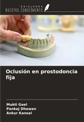 Cover: Oclusi&oacute;n en prostodoncia fija - Ediciones Nuestro Conocimiento