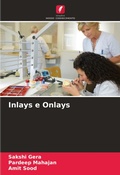 Cover: Inlays e Onlays - Edicoes Nosso Conhecimento
