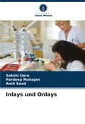 Cover: Inlays und Onlays - Verlag Unser Wissen