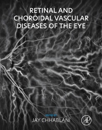 Abbildung von: Retinal and Choroidal Vascular Diseases of the Eye - Academic Press