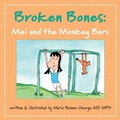 Cover: Broken Bones - Cambridge University Press