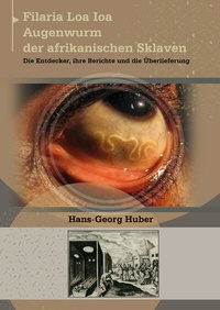 Abbildung von: Filaria Loa loa - Augenwurm der afrikanischen Sklaven - Shaker