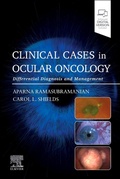 Cover: Clinical Cases in Ocular Oncology - Churchill Livingstone