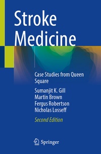 Abbildung von: Stroke Medicine - Springer