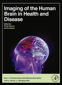 Abbildung von: Imaging of the Human Brain in Health and Disease - Academic Press