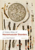 Abbildung von: A Video Atlas of Neuromuscular Disorders - OUP eBook