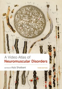 Abbildung von: A Video Atlas of Neuromuscular Disorders - OUP eBook