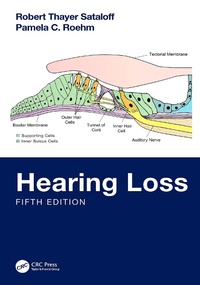 Abbildung von: Hearing Loss - CRC Press