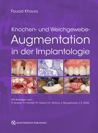 Abbildung von: Knochen- und Weichgewebeaugmentation in der Implantologie - Quintessenz Verlag