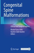 Cover: Congenital Spine Malformations - Springer