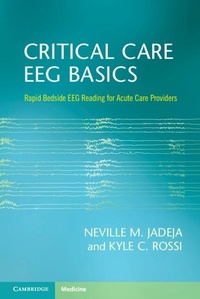 Abbildung von: Critical Care EEG Basics - Cambridge University Press