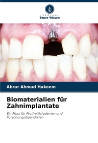 Abbildung von: Biomaterialien fuer Zahnimplantate - Verlag Unser Wissen