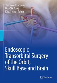 Enlarge image Cover: Endoscopic Transorbital Surgery of the Orbit, Skull Base and Brain - Springer
