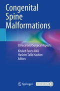 Cover: Congenital Spine Malformations - Springer
