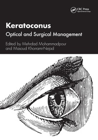 Abbildung von: Keratoconus - CRC Press