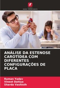 Cover: Analise Da Estenose Carotidea Com Diferentes Configuracoes de Placa - Edicoes Nosso Conhecimento
