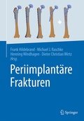 Cover: Periimplant&auml;re Frakturen - Springer
