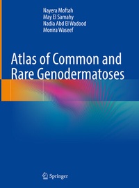Abbildung von: Atlas of Common and Rare Genodermatoses - Springer