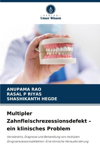 Enlarge image Cover: Multipler Zahnfleischrezessionsdefekt - ein klinisches Problem - Verlag Unser Wissen