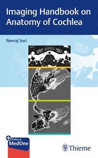 Abbildung von: Imaging Handbook on Anatomy of Cochlea - Thieme
