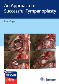 Enlarge image Cover: An Approach to Successful Tympanoplasty - Thieme Publishers