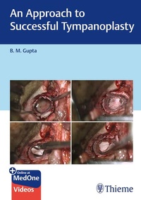 Enlarge image Cover: An Approach to Successful Tympanoplasty - Thieme Publishers