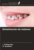 Cover: Distalizaci&oacute;n de molares - Ediciones Nuestro Conocimiento