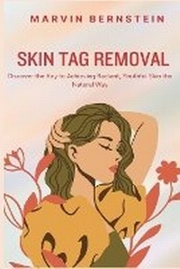 Abbildung von: Skin Tag Removal - NewLife Publishing