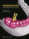 Cover: Prefabricated Posts - Quintessence Publishing Co. Ltd.