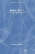 Cover: Vascular Surgery: - CRC Press
