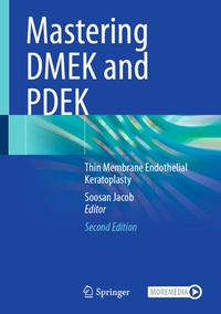 Enlarge image Cover: Mastering DMEK and PDEK - Springer