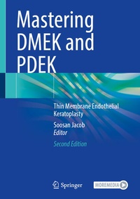 Enlarge image Cover: Mastering DMEK and PDEK - Springer
