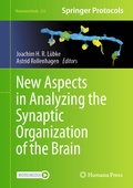 Bild: New Aspects in Analyzing the Synaptic Organization of the Brain - Humana