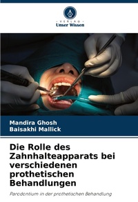 Abbildung von: Die Rolle des Zahnhalteapparats bei verschiedenen prothetischen Behandlungen - Verlag Unser Wissen