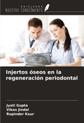 Cover: Injertos &oacute;seos en la regeneraci&oacute;n periodontal - Ediciones Nuestro Conocimiento
