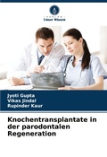 Cover: Knochentransplantate in der parodontalen Regeneration - Verlag Unser Wissen